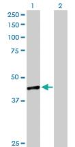 Anti-TWF1 Rabbit Polyclonal Antibody