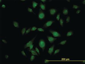 Anti-ATP2C1 Mouse Monoclonal Antibody [clone: 2G1]