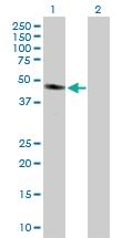 Anti-GMPPA Rabbit Polyclonal Antibody