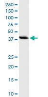 Anti-DNMT3L Polyclonal Antibody Pair