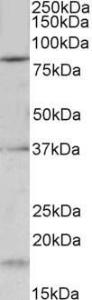 Anti-Kcnc3 Antibody (A85013) (0.2 µg/ml) staining of Mouse fetal Brain lysate (35 µg protein in RIPA buffer). Primary incubation was 1 hour. Detected by chemiluminescence