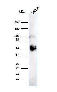 Western blot analysis of HeLa cell lysate using Anti-FOXA1 Antibody [FOXA1/1241]