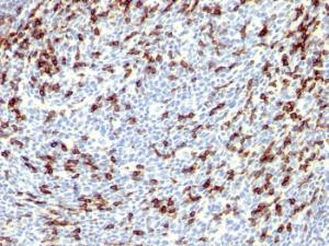 Immunohistochemical analysis of formalin-fixed, paraffin-embedded human tonsil using Anti-PD1 Antibody