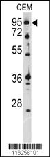 Anti-ATXN1 Rabbit Polyclonal Antibody