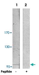 Anti-ACTN3 Rabbit Polyclonal Antibody