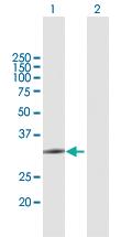 Anti-ZCCHC9 Mouse Polyclonal Antibody