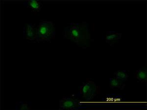 Anti-RUNX1 Mouse Monoclonal Antibody [clone: 2C10]