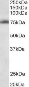 Anti-TSPYL2 Antibody (A85014) (0.3µg/ml) staining of Jurkat lysate (35µg protein in RIPA buffer). Primary incubation was 1 hour. Detected by chemiluminescence.