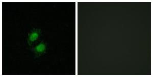 Immunofluorescence analysis of A549 cells using Anti-ZNF95 Antibody. The right hand panel represents a negative control, where the antibody was pre-incubated with the immunising peptide