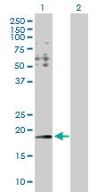 Anti-HYI Rabbit Polyclonal Antibody