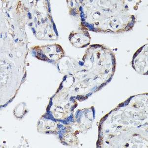 Immunohistochemistry analysis of paraffin-embedded human placenta using Anti-MAP3K4 Antibody (A93094) at a dilution of 1:100 (40x lens)