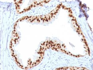 Immunohistochemical analysis of formalin-fixed, paraffin-embedded human prostate using Anti-FOXA1 Antibody [FOXA1/1512]