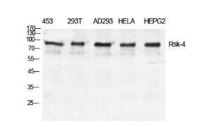 Western blot analysis of various cells using Anti-S6K-alpha6 Antibody