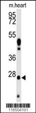 Anti-WDYHV1 Rabbit Polyclonal Antibody