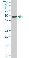 Anti-STK38 Mouse Monoclonal Antibody [clone: 2F3]