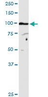 Anti-ANAPC5 Rabbit Polyclonal Antibody