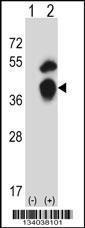 Anti-GTF2B Rabbit Polyclonal Antibody (APC (Allophycocyanin))