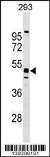 Anti-MTL5 Rabbit Polyclonal Antibody (Biotin)