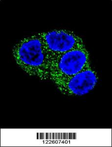 Anti-UGT1A1 Rabbit Polyclonal Antibody (FITC (Fluorescein Isothiocyanate))