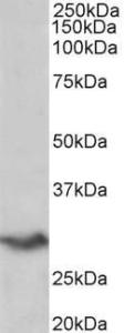 Anti-VTCN1 Antibody (A85015) (0.2µg/ml) staining of Human Spleen lysate (35µg protein in RIPA buffer). Primary incubation was 1 hour. Detected by chemiluminescence.