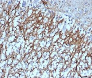 Immunohistochemical analysis of formalin-fixed, paraffin-embedded human cerebellum tissue using Anti-GFAP Antibody [GFAP/6879]