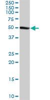 Anti-GMPPA Rabbit Polyclonal Antibody