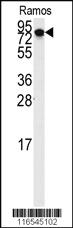 Anti-DLGAP5 Rabbit Polyclonal Antibody