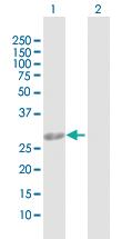 Anti-AK2 Rabbit Polyclonal Antibody