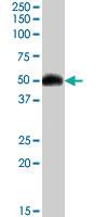 Anti-HCRTR2 Goat Polyclonal Antibody