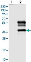 Anti-TTC19 Rabbit Polyclonal Antibody