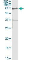 Anti-ALPPL2 Antibody Pair