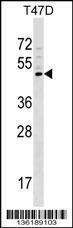 Anti-GCNT1 Rabbit Polyclonal Antibody (HRP (Horseradish Peroxidase))