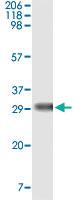 Anti-NPM Mouse Monoclonal Antibody [clone: 7H10B9]