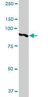 Anti-ANAPC5 Rabbit Polyclonal Antibody