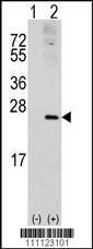 Anti-RAC1 Rabbit Polyclonal Antibody (AP (Alkaline Phosphatase))