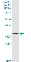 Anti-AK2 Rabbit Polyclonal Antibody