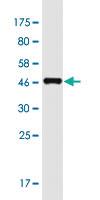 Anti-DACT1 Mouse Monoclonal Antibody [clone: 5D8]