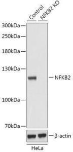 Western blot analysis of extracts from normal (control) and NF-ÎºB2 knockout (KO) HeLa cells, using Anti-NFkB p100/NFKB2 Antibody (A93099) at 1:1000 dilution. The secondary Antibody was Goat Anti-Rabbit IgG H&L Antibody (HRP) at 1:10000 dilution