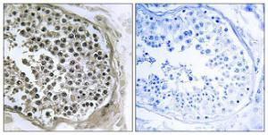 Immunohistochemical analysis of paraffin-embedded human testis tissue using Anti-GIDRP88 Antibody The right hand panel represents a negative control, where the antibody was pre-incubated with the immunising peptide