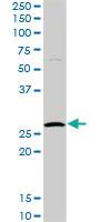 Anti-HYI Rabbit Polyclonal Antibody