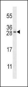 Anti-DUT Rabbit Polyclonal Antibody (APC (Allophycocyanin))