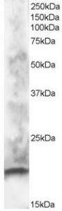 Anti-CABP1 Antibody (A83391) staining (1µg/ml) of human brain lysate (RIPA buffer, 30µg total protein per lane). Primary incubated for 1 hour. Detected by western blot using chemiluminescence.