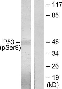 Western blot analysis of lysates from LOVO cells using Anti-p53 (phospho Ser9) Antibody. The right hand lane represents a negative control, where the Antibody is blocked by the immunising peptide