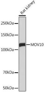 Western blot analysis of extracts of Rat kidney, using Anti-Mov10 Antibody [ARC1817] (A305278) at 1:1,000 dilution. The secondary antibody was Goat Anti-Rabbit IgG H&L Antibody (HRP) at 1:10,000 dilution.