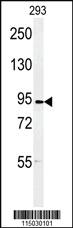 Anti-DLGAP5 Rabbit Polyclonal Antibody