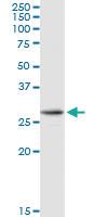 Anti-AK2 Rabbit Polyclonal Antibody