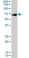 Anti-MMP12 Rabbit Polyclonal Antibody