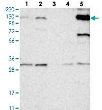 Anti-ANKRD35 Rabbit Polyclonal Antibody