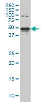 Anti-STK38 Mouse Monoclonal Antibody [clone: 2F3]