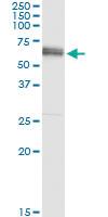 Anti-ALPPL2 Polyclonal Antibody Pair